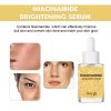 HOYGI Niacinamide Brightening Serum, Lightening Spots And Fine Lines Brightening Skin Hydrating Moisturizing Facial
